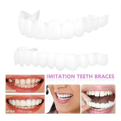 💝Last day discount-50%Off🔥Latest👨⚕Adjustable Snap-On Dentures😁