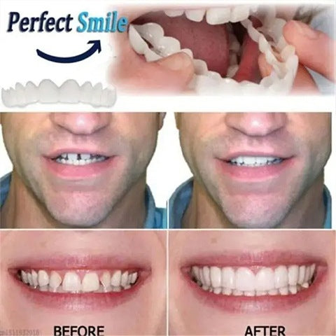 💝Last day discount-50%Off🔥Latest👨⚕Adjustable Snap-On Dentures😁
