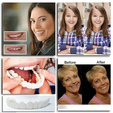 💝Last day discount-50%Off🔥Latest👨⚕Adjustable Snap-On Dentures😁