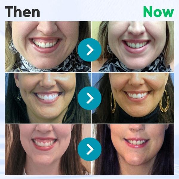 (š CHRISTMAS SALE - 80% OFF! š„ LAST DAY!) Taileden⢠Gum Therapy Gel)