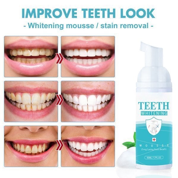 🎄 EARLY CHRISTMAS SALE 60% OFF🎁 TEETH WHITENING MOUSSE