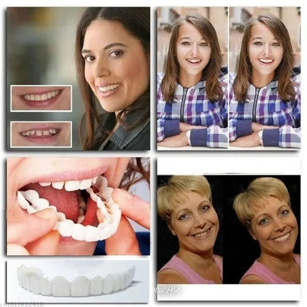 Last day discount-(50%Off)- Adjustable dentures