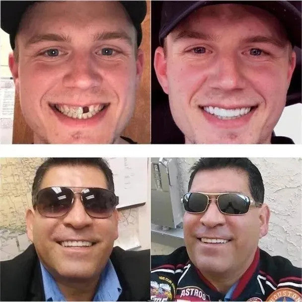 Last day discount-(50%Off)- Adjustable dentures