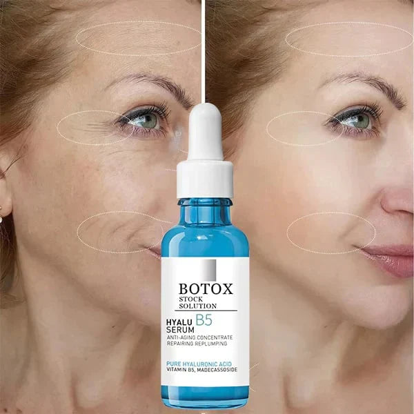 💝Last Day Promotion 70% OFF💝-Botox Serum Facial Essence