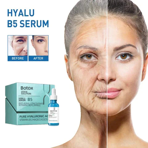 💝Last Day Promotion 70% OFF💝-Botox Serum Facial Essence